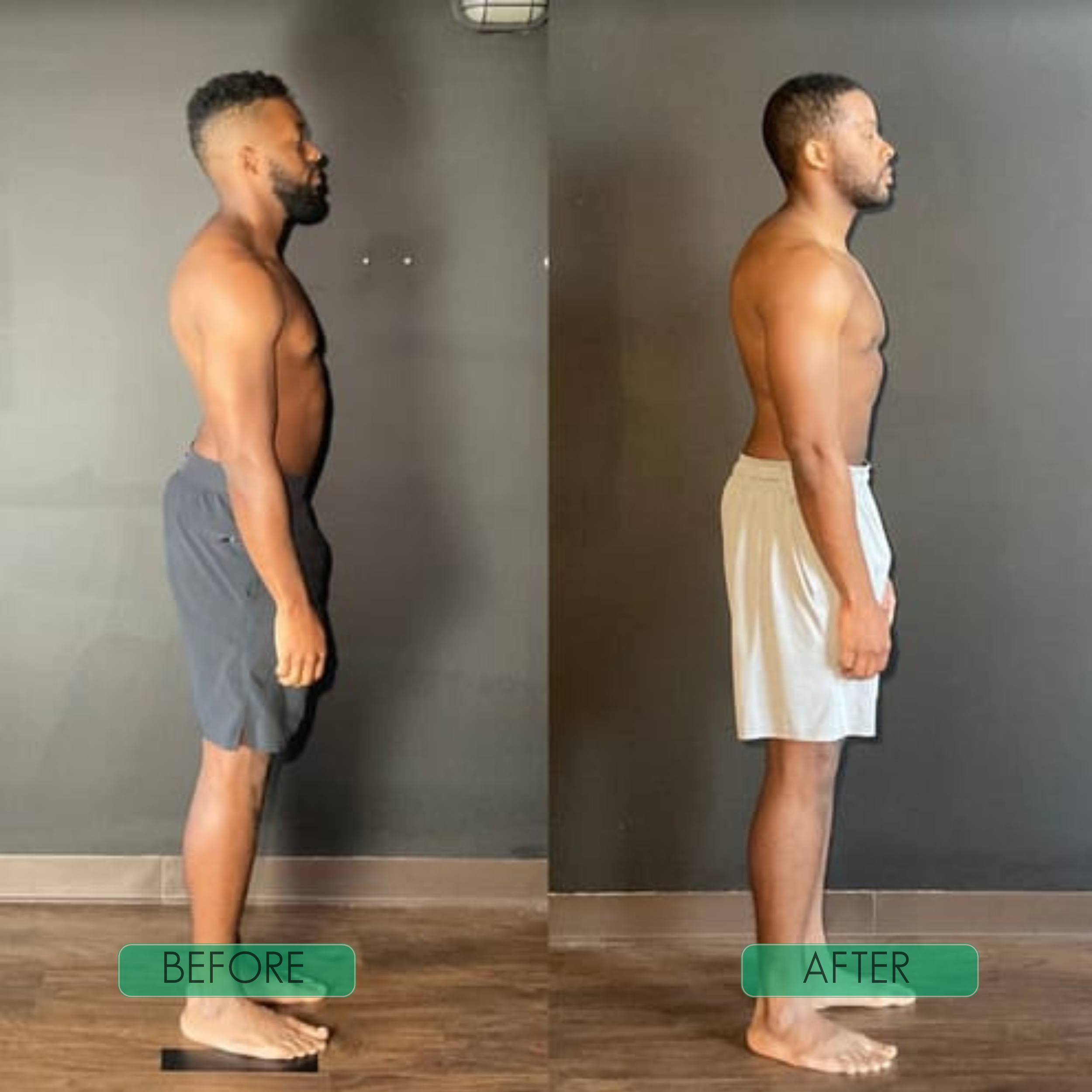 AlignPro™ – Feel Strong and Upright All Day [50% Off]