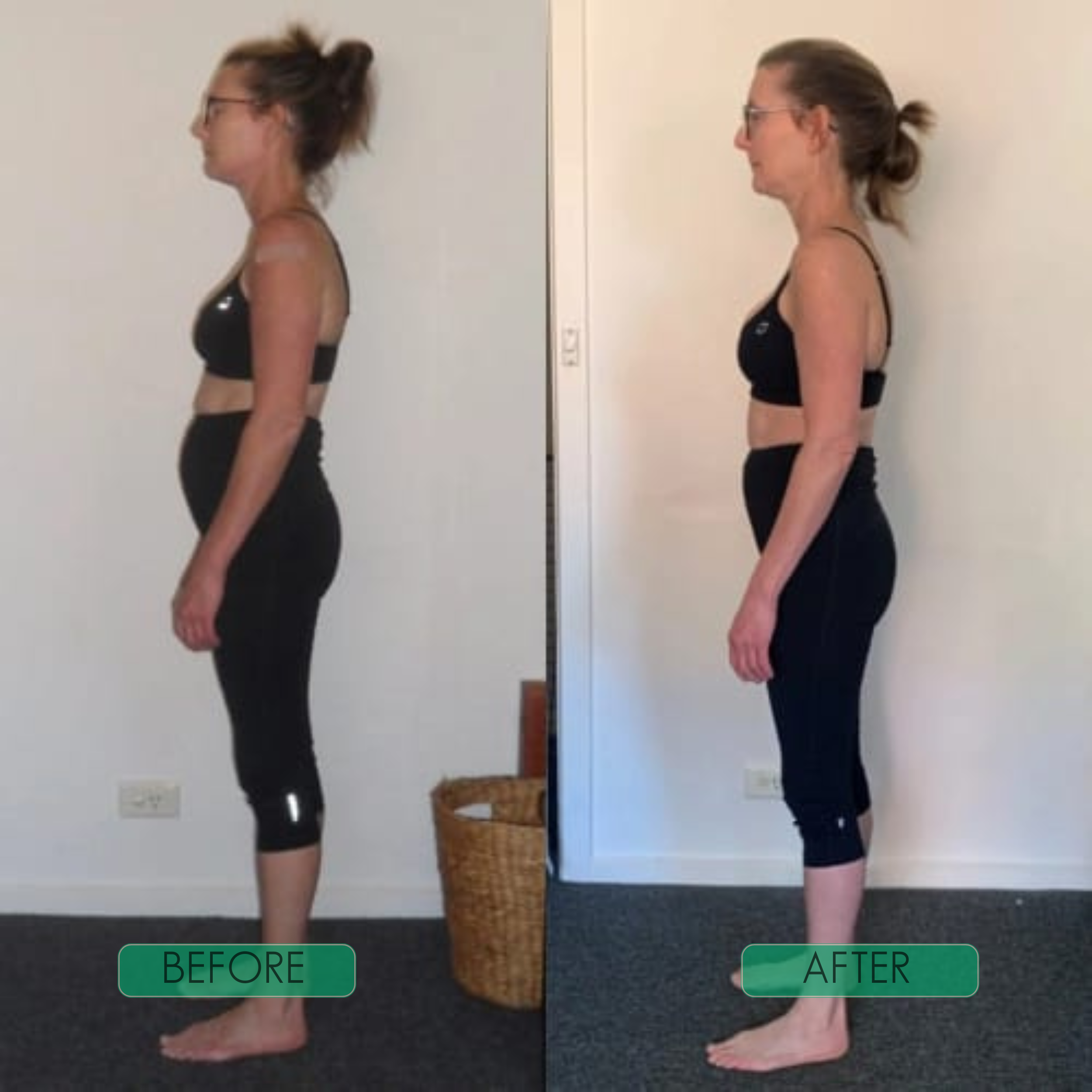 AlignPro™ – Feel Strong and Upright All Day [50% Off]