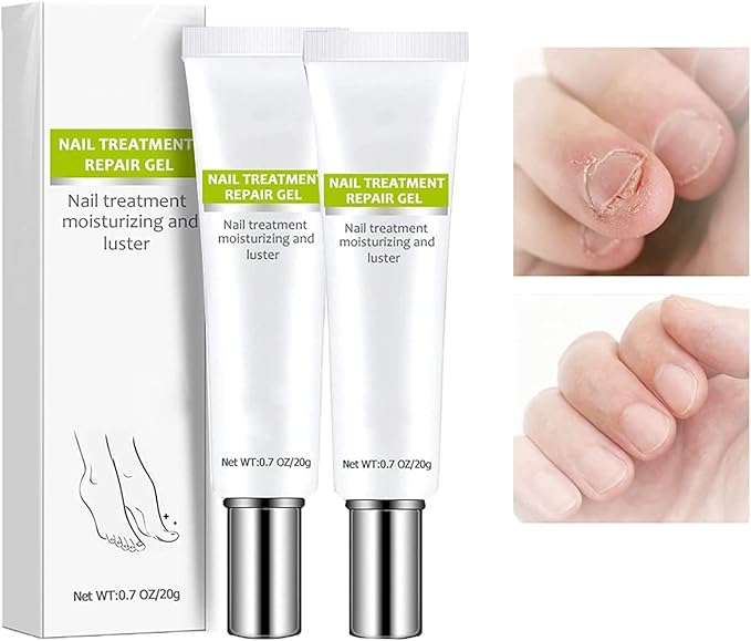 RejuveNail™ – Strengthens Healthy, Beautiful Nails Long-Term [1 + 1 Free]