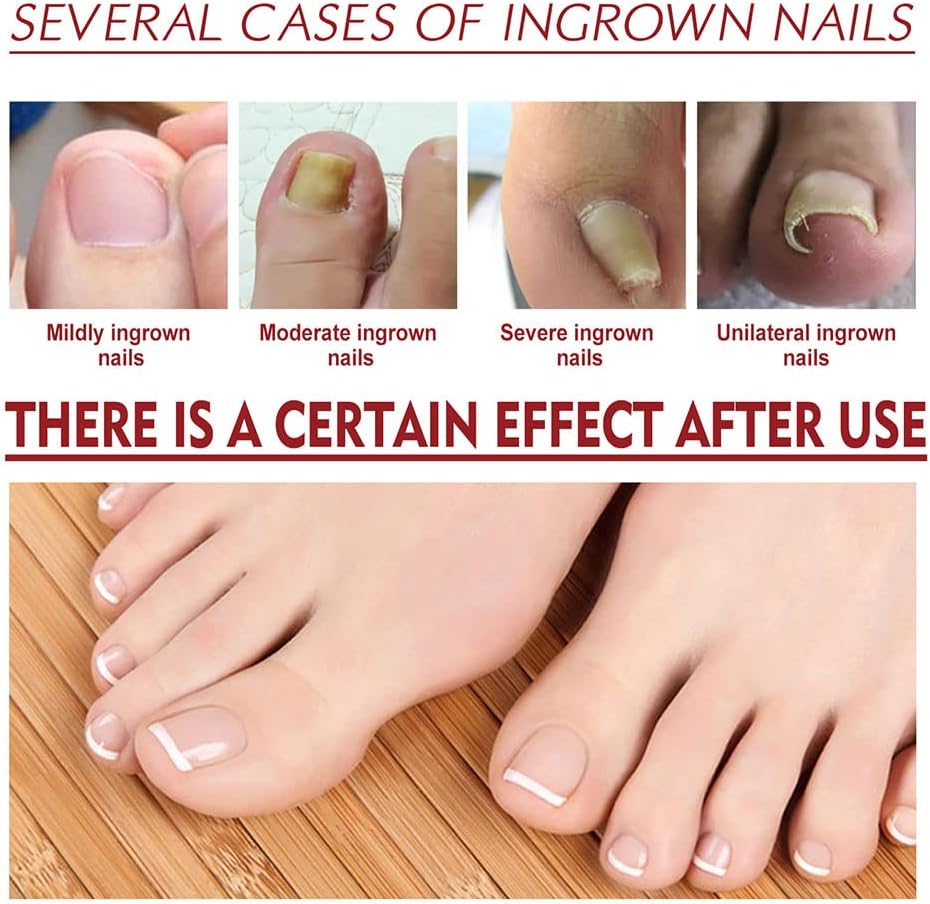 HealDrop™ – Repairs Damaged, Brittle Nails Effectively in Just 4 Weeks [50% Off]