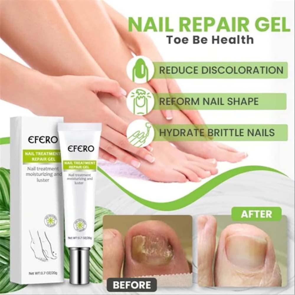 RejuveNail™ – Strengthens Healthy, Beautiful Nails Long-Term [1 + 1 Free]