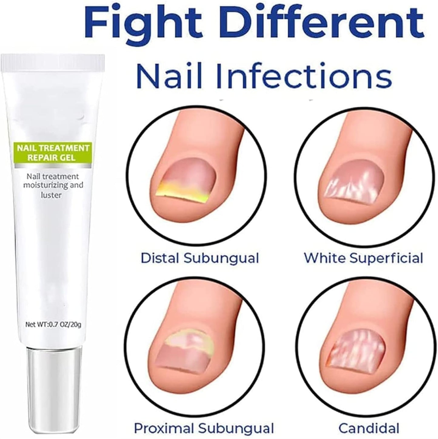 RejuveNail™ – Strengthens Healthy, Beautiful Nails Long-Term [1 + 1 Free]