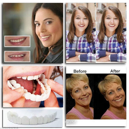 SnapOn™ – Clip-On Denture for a Radiant Smile [1 + 1 Free]