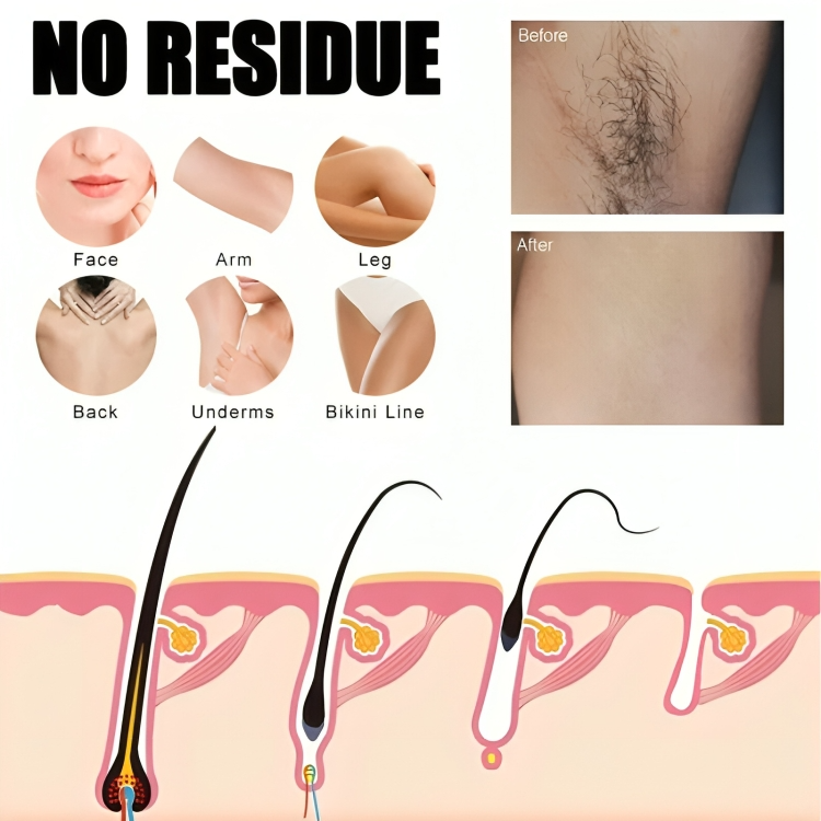 Painless Hair Removal Spray for Smooth Skin – Gentle & Hypoallergenic