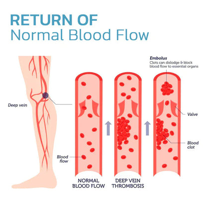 ShapeSocks™ – The Ultimate Secret Trick for Faster Weight Loss Support [1 + 1 Free]