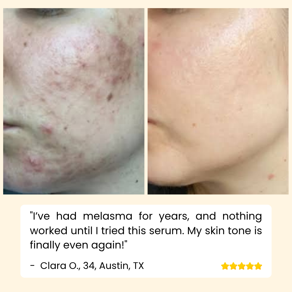 Vitamin C Serum for Face, Hands & Body – Radiant Skin Care