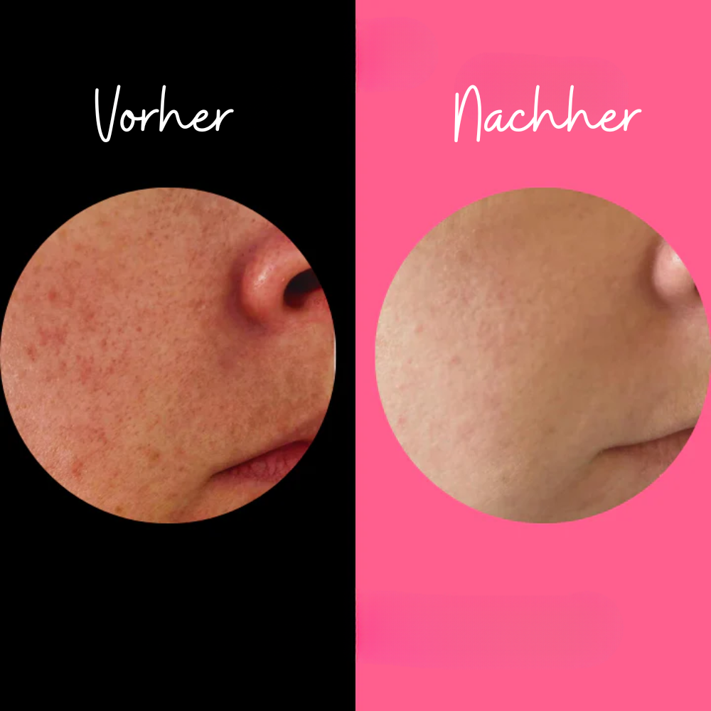 Gentle Exfoliating Sponge for Sensitive Skin – Chemical-Free Body Scrub