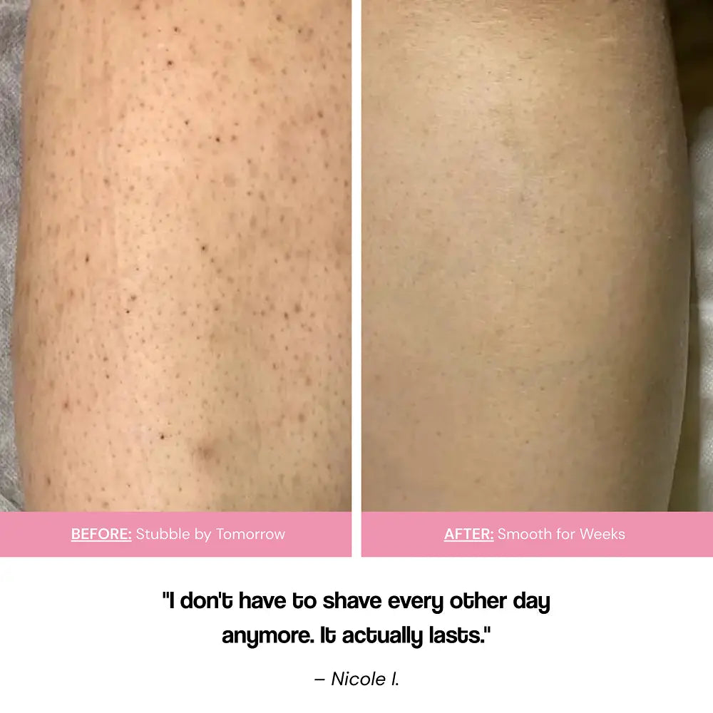 Gentle Hair Removal Cream with Vitamin E & Provitamin B5 for Smooth Skin