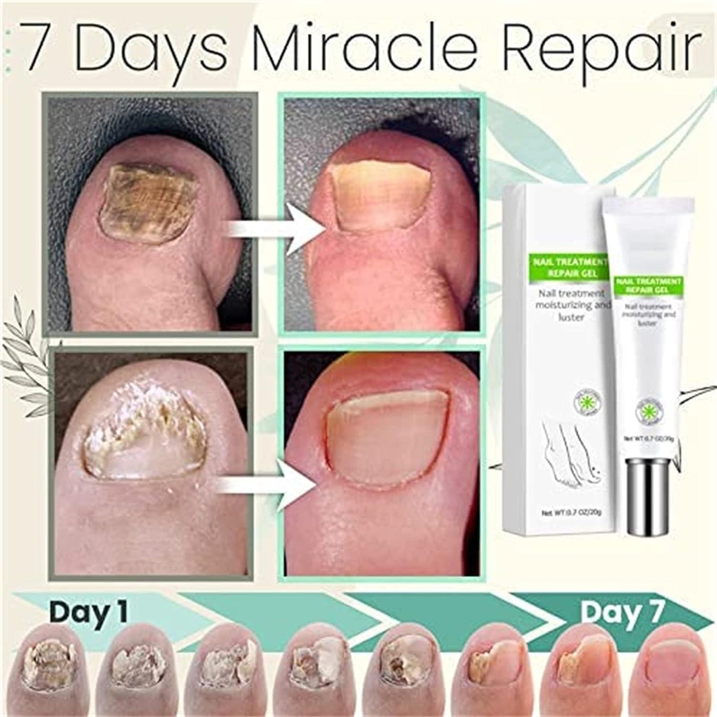 RejuveNail™ – Strengthens Healthy, Beautiful Nails Long-Term [1 + 1 Free]