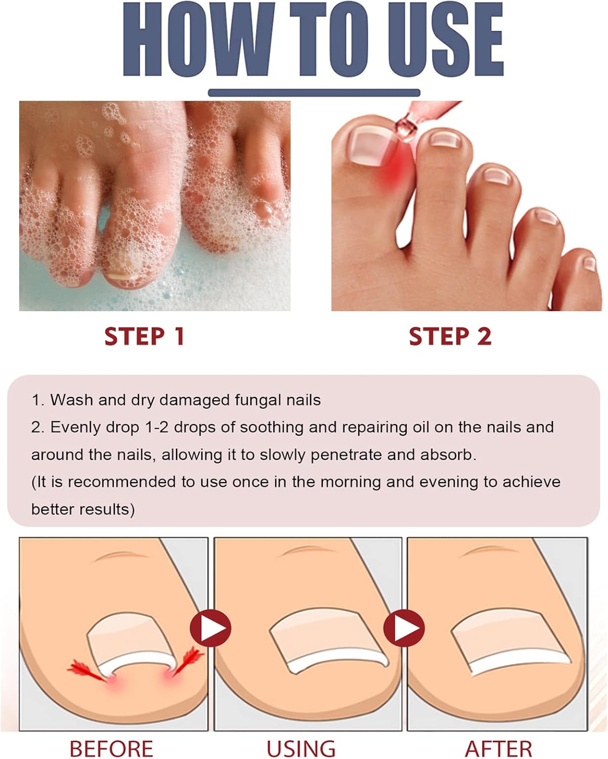 ToePerfect™ Intensive Care for Well-Groomed Toenails & Fingernails [1 + 1 Free]