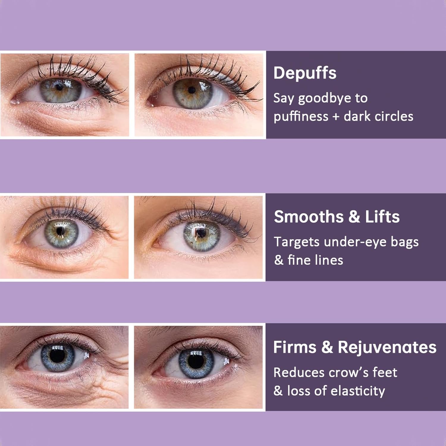 YouthEyes™ – For visibly younger, radiant & refreshed eyes [1 + 1 Free]