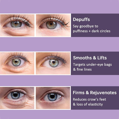 YouthEyes™ – For visibly younger, radiant & refreshed eyes [1 + 1 Free]