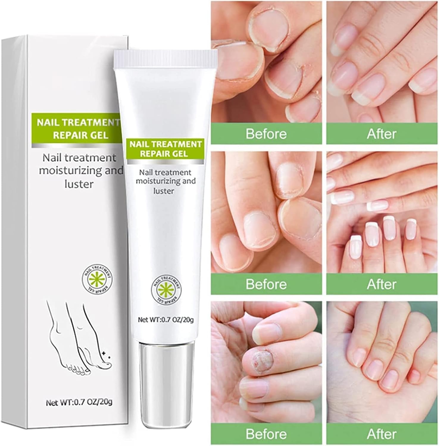 RejuveNail™ – Strengthens Healthy, Beautiful Nails Long-Term [1 + 1 Free]