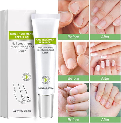 RejuveNail™ – Strengthens Healthy, Beautiful Nails Long-Term [1 + 1 Free]