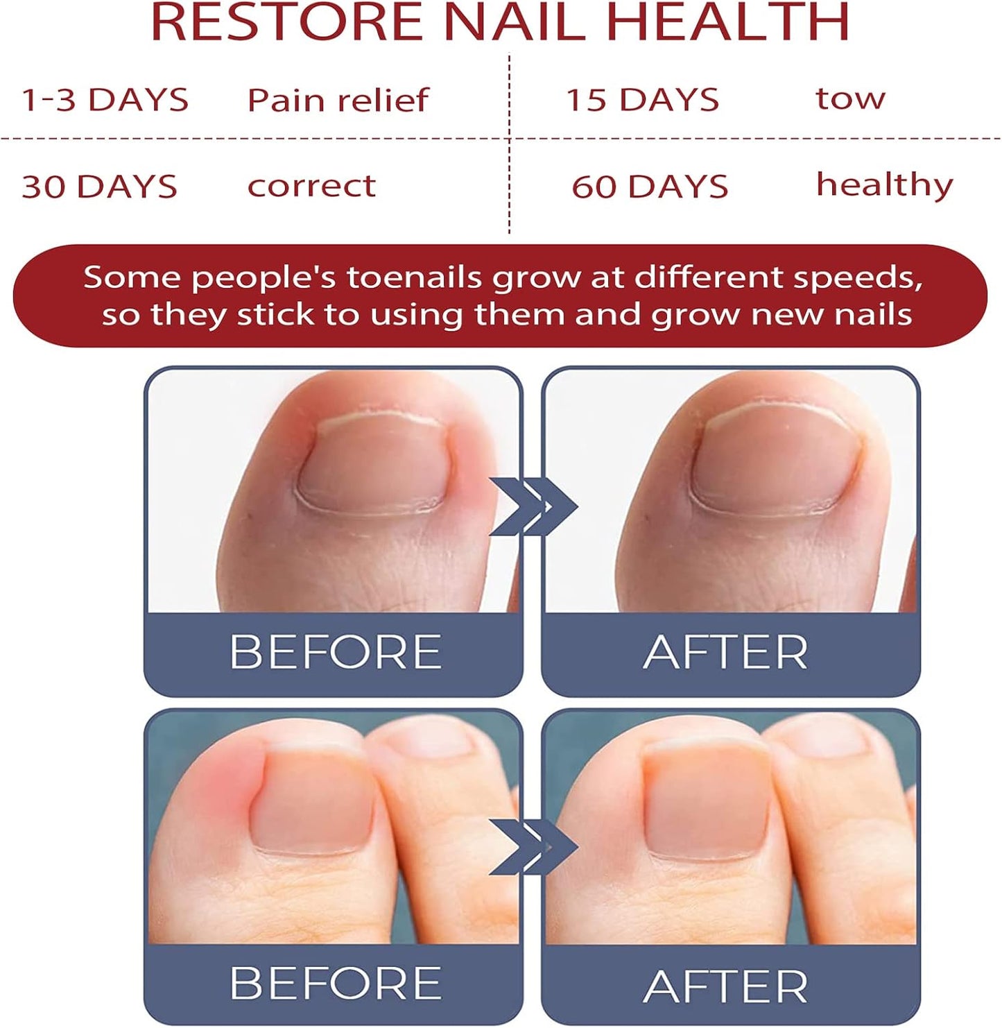 ToePerfect™ Intensive Care for Well-Groomed Toenails & Fingernails [1 + 1 Free]