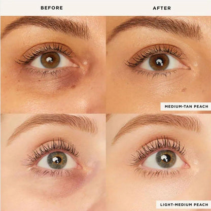 LumiraCover™ – Say Goodbye to Dark Circles and Radiate Youthful Freshness Everyday Glow [1 + 1 Free]