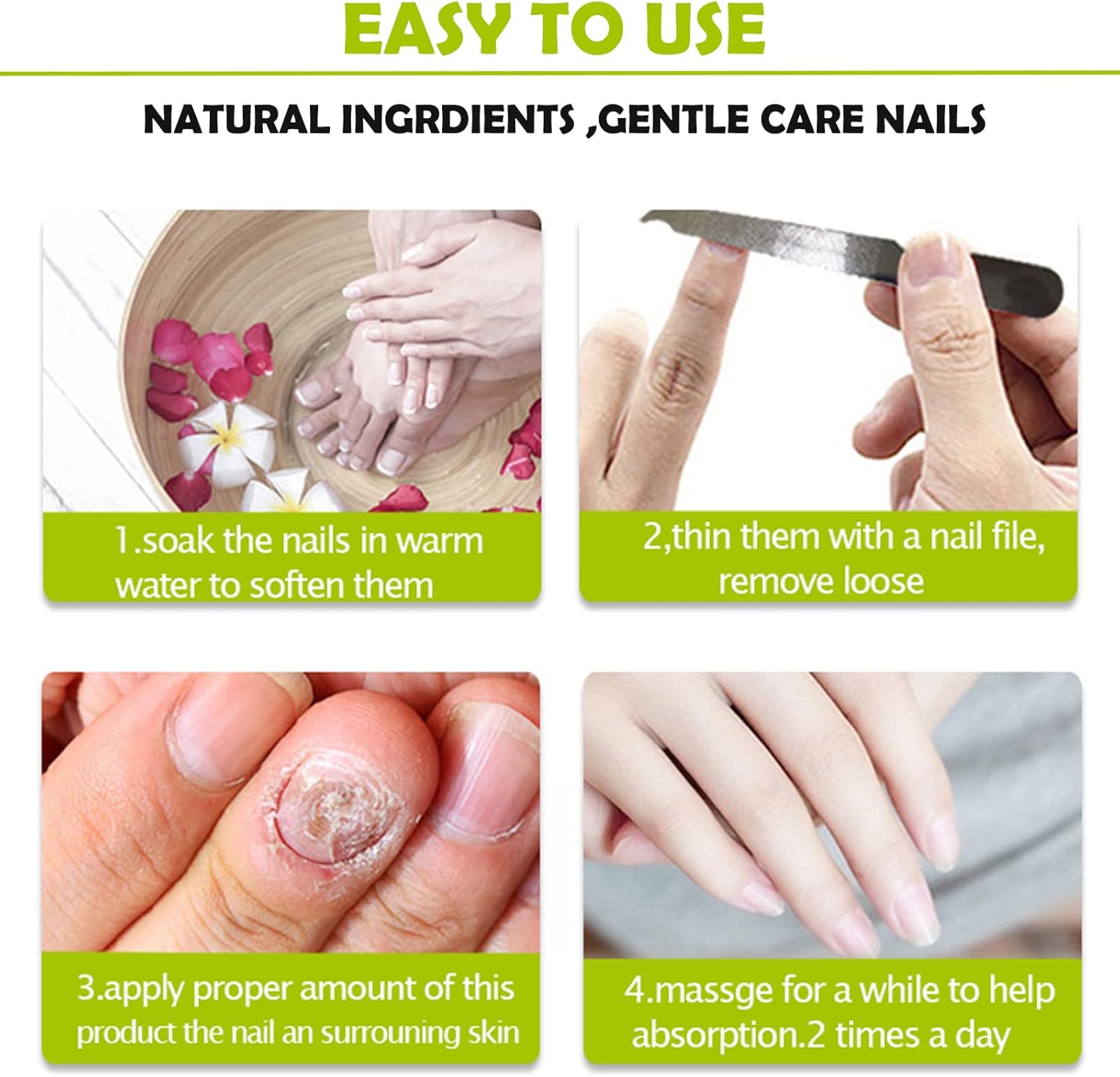 RejuveNail™ – Strengthens Healthy, Beautiful Nails Long-Term [1 + 1 Free]