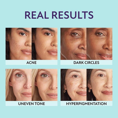 Hydrating Concealer | All-in-One Complexion Perfector | SupremeCrème