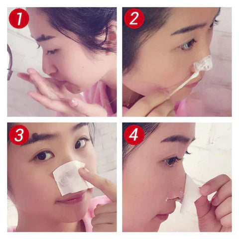 Pore Cleansing Patches with Activated Charcoal & Aloe Vera – 2x 20 Pieces