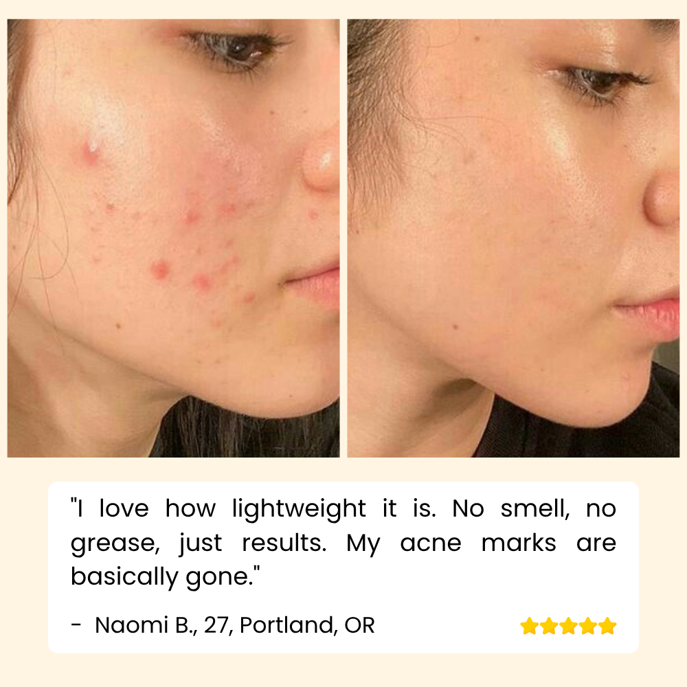 Vitamin C Serum for Face, Hands & Body – Radiant Skin Care