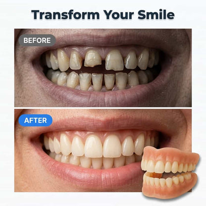CustomDenture – Naturally Beautiful Teeth Without Adhesive – 50% Off