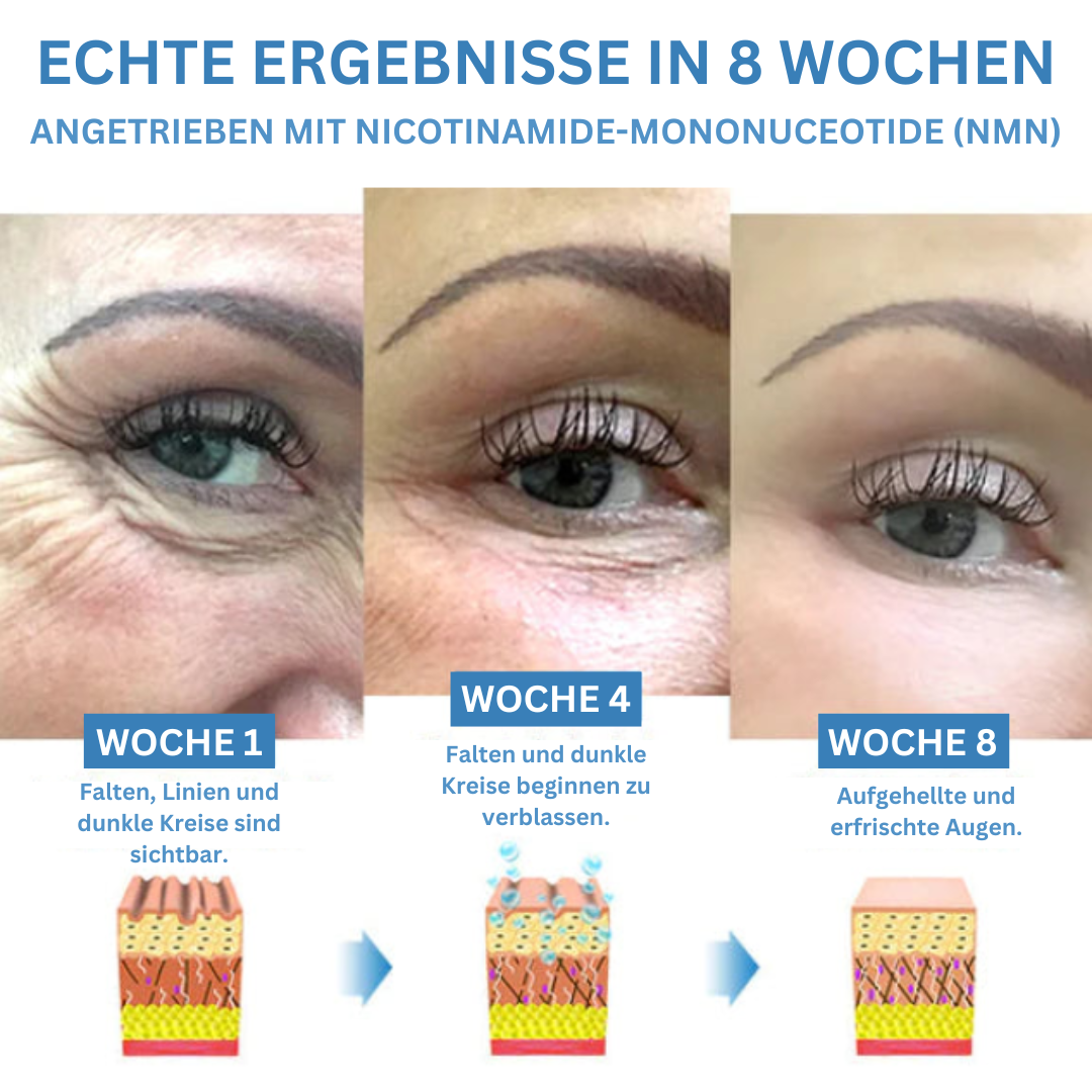 GlowLift™ – Eye Care for Instant Revelation of Radiant, Youthful, and Fresh Eyes [1 + 1 Free]