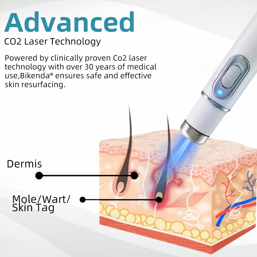 CO2 Laser Pen for Skin Blemish Removal – At-Home Precision Spot Treatment