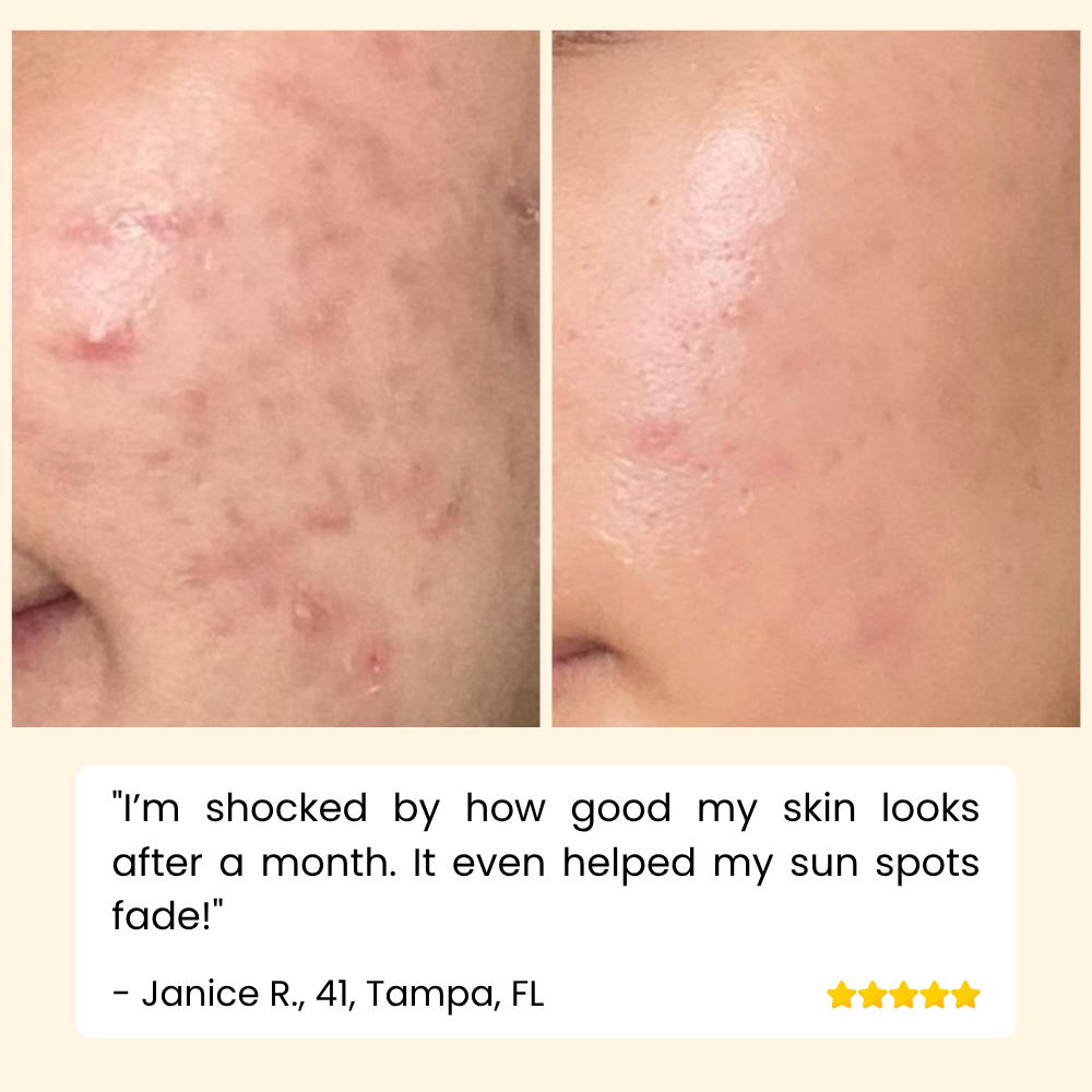Vitamin C Serum for Face, Hands & Body – Radiant Skin Care