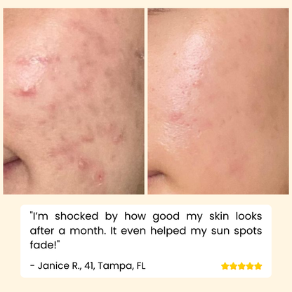 HoyGi – Eternity Vitamin C Serum for Face, Hands, and Body for Radiant Skin [1 + 1 Free]