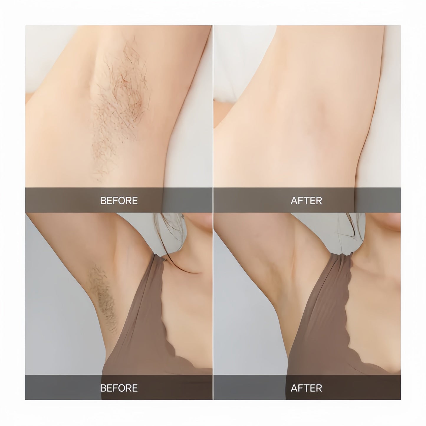 Removex – Painless Hair Removal for Silky Smooth Skin [50% Off]