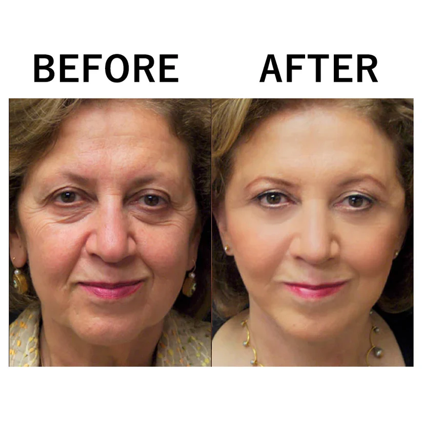 HydraLift – Intensive care for radiant and well-groomed skin with moisture [1 + 1 Free]