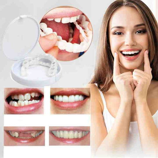 SnapOn™ – Clip-On Denture for a Radiant Smile [1 + 1 Free]