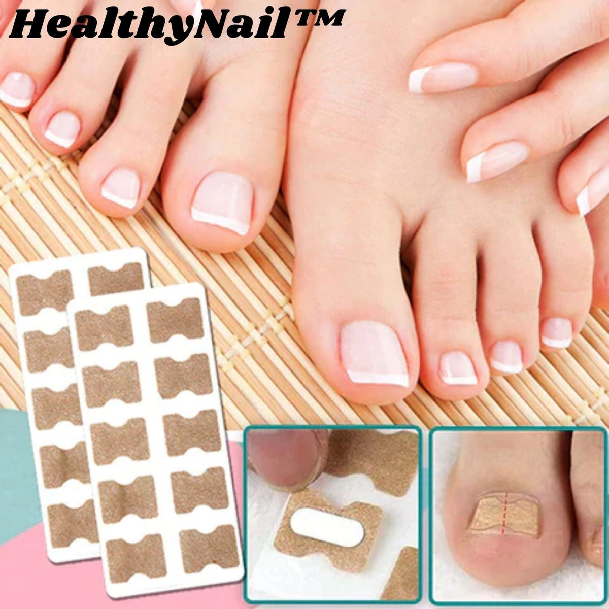 Nail Correction Strips for Ingrown & Uneven Nails – 50 Pieces