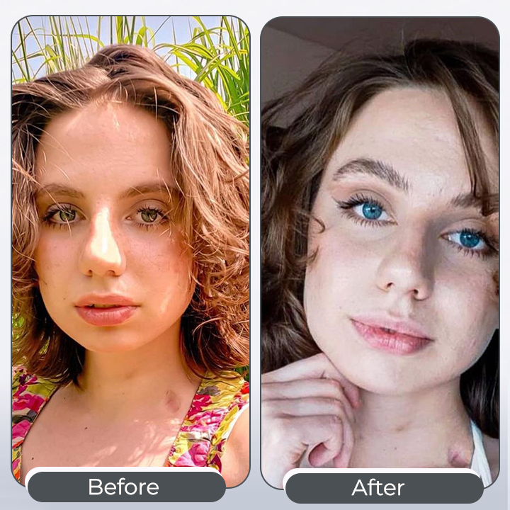 Color Change Eye Drops for Temporary Iris Color Enhancement