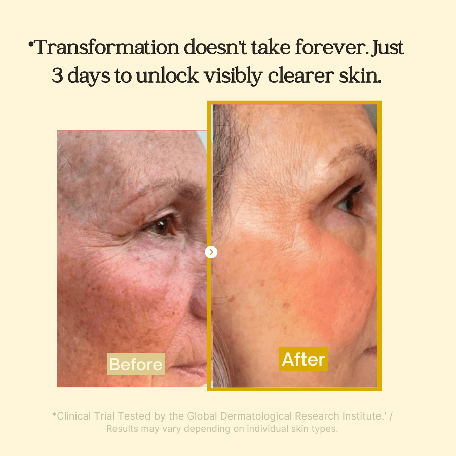 Kojic Acid Peel-Off Face Mask for Dark Spots & Even Skin Tone