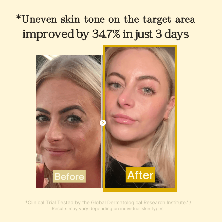Kojic Acid Peel-Off Face Mask for Dark Spots & Even Skin Tone