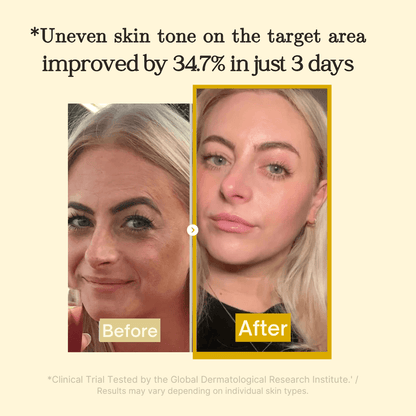 LumeSkin – Brightening Face Mask for Radiant Even Skin [1 + 1 Free]
