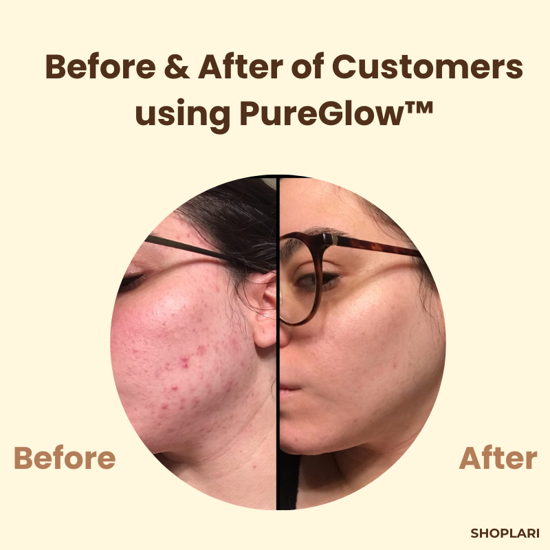 Black Tea Face Mask | Deep Pore Cleansing | Antioxidant Care | PureGlow Black Tea Mask