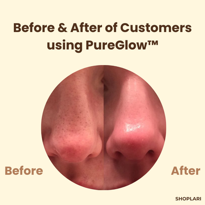 PureGlow™ – Deep Pore Cleansing with Antioxidant Care: PureGlow Black Tea Mask [50% Off]