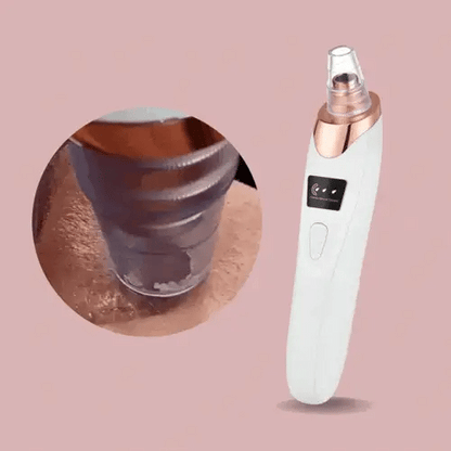 Blackhead Remover Vacuum | Deep Pore Cleanser | Adjustable Suction | Rechargeable | PureLure