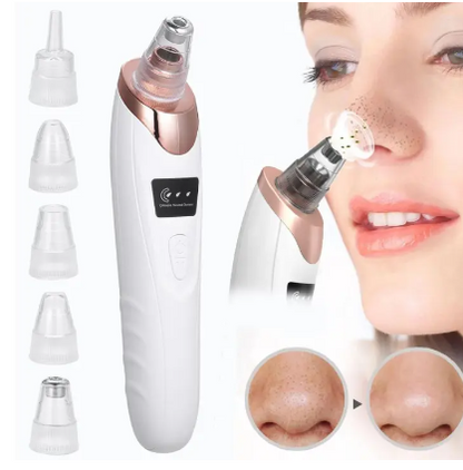 Blackhead Remover Vacuum | Deep Pore Cleanser | Adjustable Suction | Rechargeable | PureLure