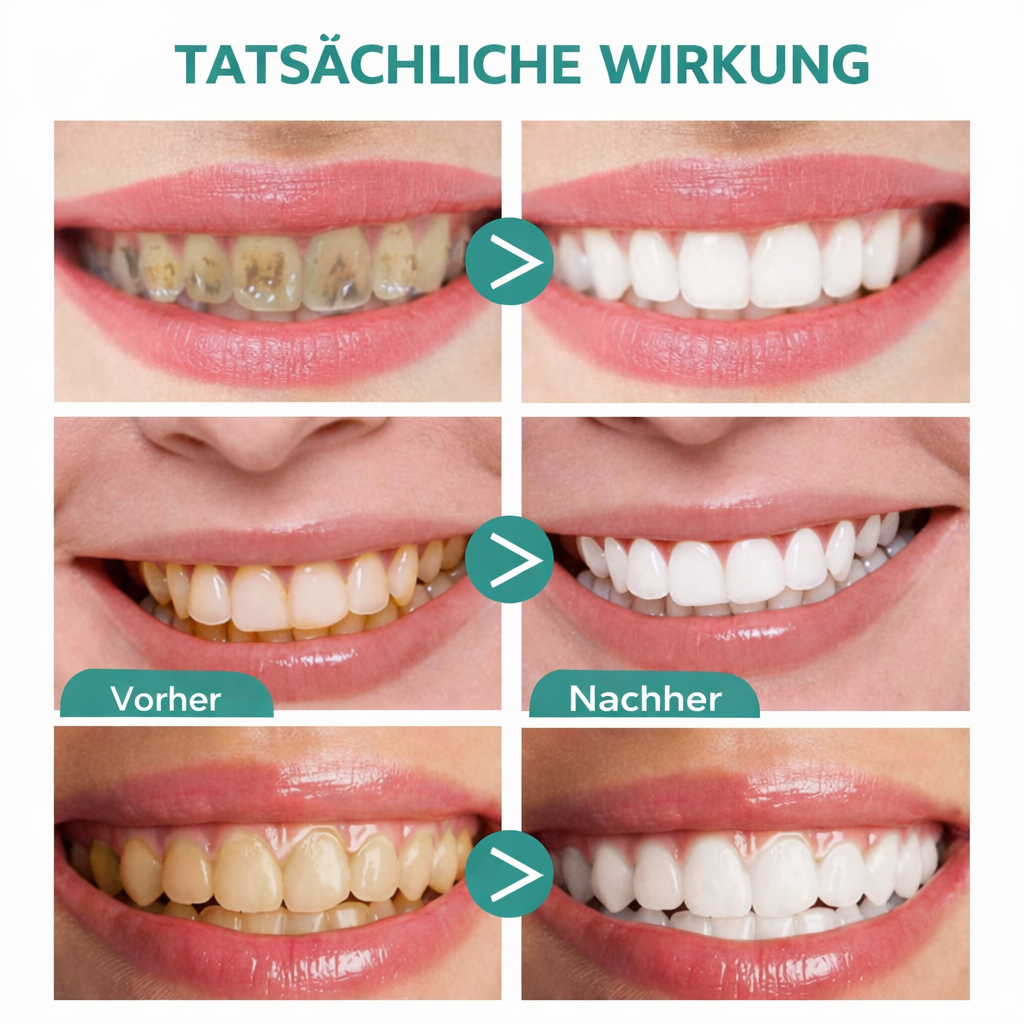 Teeth Whitening Foam Toothpaste – Gentle Stain Removal for Brighter Teeth