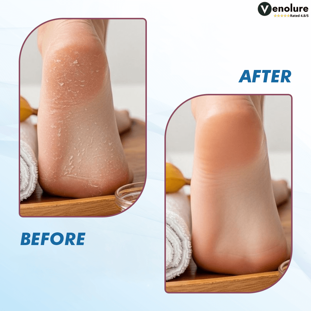 Electric Callus Remover for Feet with 3 Speed Settings & LED Light