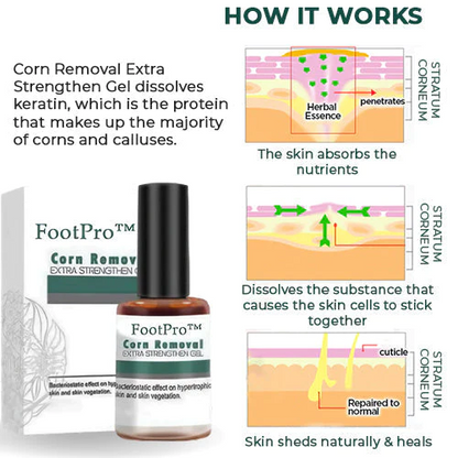 Corn Removal Gel | Extra Strength Formula | Precision Applicator | FootPro