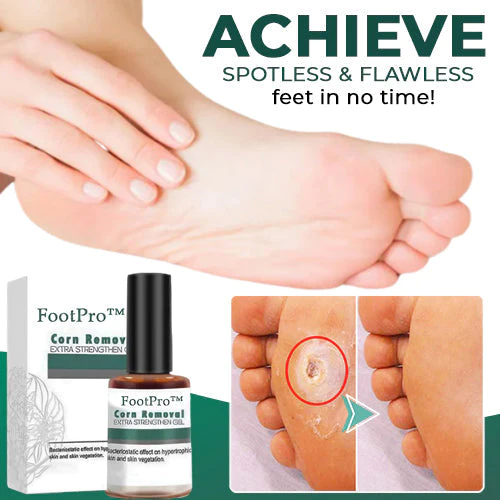 Corn Removal Gel | Extra Strength Formula | Precision Applicator | FootPro