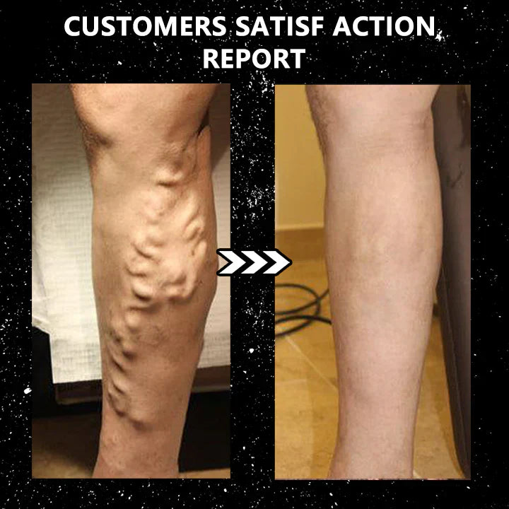 ShapeSocks™ – The Ultimate Trick to Accelerate Your Weight Loss [1 + 1 Free]
