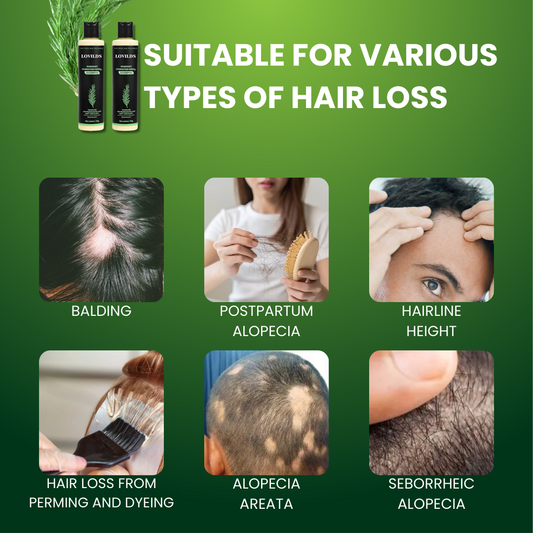 LOVILDS™ – For Thicker, Fuller Hair for Healthy, Strong & Shiny Hair Growth Everyday Care [50% Off]