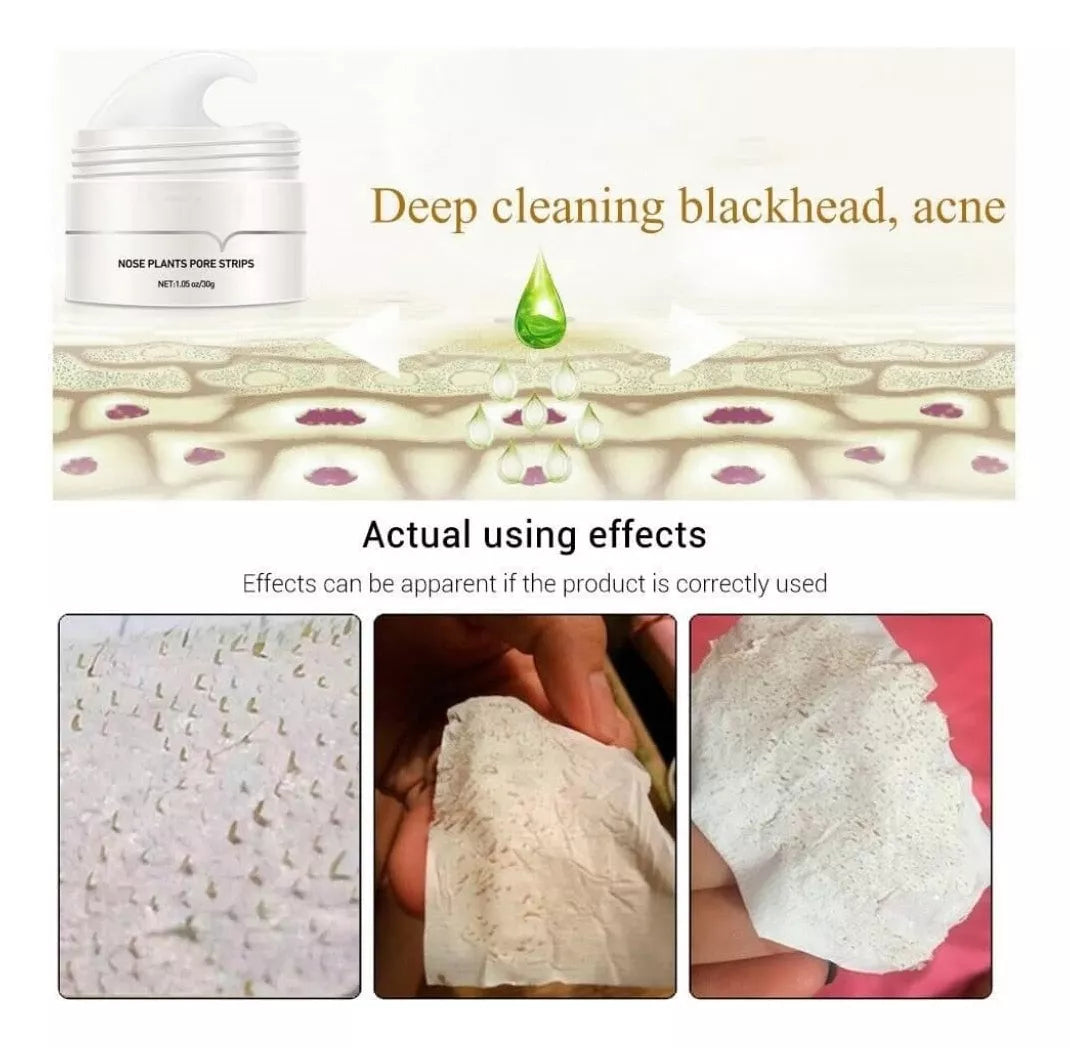 Pore Cleansing Patches with Activated Charcoal & Aloe Vera – 2x 20 Pieces