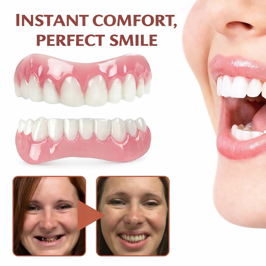 Dental Fit Kit | Soft Silicone Fit | Pain-Free & Non-Slip Comfort | Self-Adjustable | SecureSmile