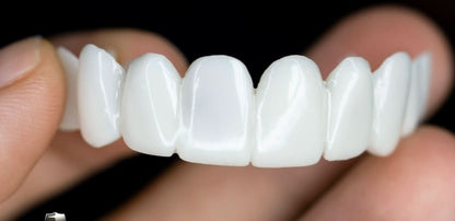 Snap On Veneers | Removable Teeth Veneers | Instant Smile Teeth Cover | SmileFlex